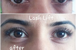Dermal fillers/ Botox / eyelash extension/ Lash lift/ Tinting -LASHCIOUS by Preeti (OPEN) Photo