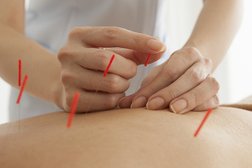 Joanne Warring Acupuncture Photo