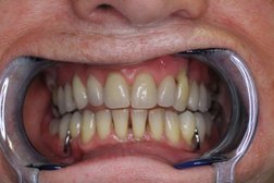 Active Dental Denture Clinic Photo