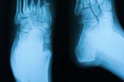 South West Foot Surgery in Swindon