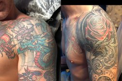 Skinfix Piercing and Tattoo Removal in Sunderland