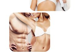 Laser Hair Removal and Beauty Ltd in Derby