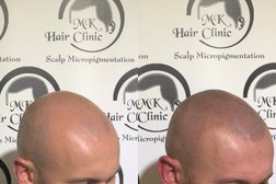 MK Hair Clinic in Derby